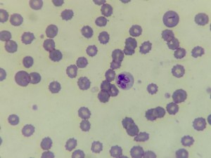 Babesia canis