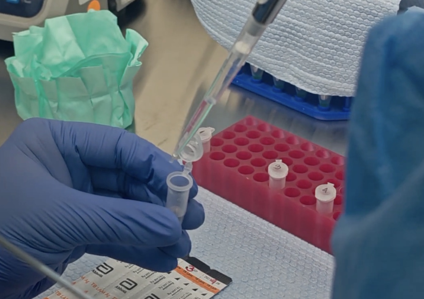 Pruebas de tuberculosis (TB)